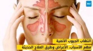 Magazine التهاب الجيوب الأنفية: فهم الأسباب، الأعراض وطرق العلاج الحديثة