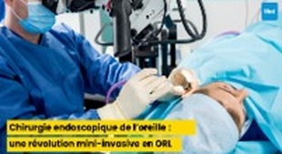 Magazine Chirurgie endoscopique de l’oreille : une révolution mini-invasive en ORL