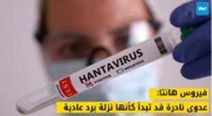 Magazine فيروس هانتا: عدوى نادرة قد تبدأ كأنها نزلة برد عادية