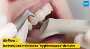 Makaleler AirFlow : la révolution invisible de l'hygiène bucco-dentaire