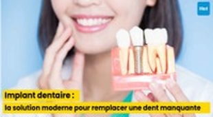 Magazine Implant dentaire : la solution moderne pour remplacer une dent manquante