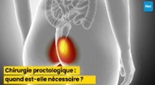 Magazine Chirurgie proctologique : quand est-elle nécessaire ?