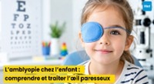 Magazine L’amblyopie chez l’enfant : comprendre et traiter l’œil paresseux