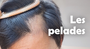 Magazine Les pelades