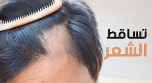 Magazine تساقط الشعر 