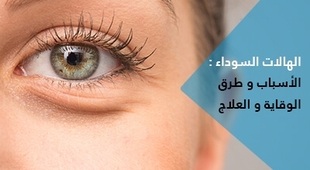 Magazine الهالات السوداء : الأسباب و طرق الوقاية و العلاج