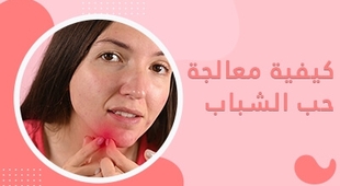 Magazine كيفية معالجة حب الشباب