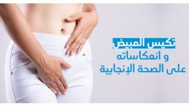 تكيس المبيض و انعكاساته على الصحة الإنجابية