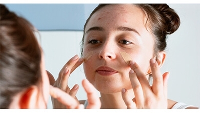 أسباب ظهور حب الشباب و طرق العلاج