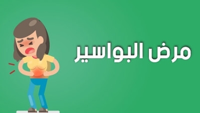 مرض البواسير