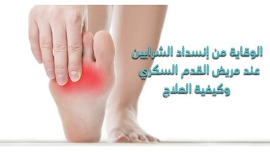 الوقاية من إنسداد الشّرايين عند مريض القدم السّكّري وكيفيّة العلاج