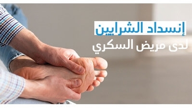 إنسداد الشّرايين لدى مريض السّكّري ( إعتلال شرايين الأطراف السّفلى)