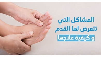 المشاكل الّتي تتعرّض لها القدم و كيفيّة علاجها
