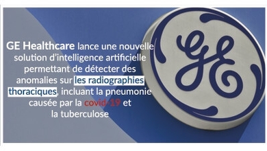 GE Healthcare lance une nouvelle solution d’intelligence artificielle permettant de détecter des anomalies sur les radiographies thoraciques, incluant la pneumonie causée par la covid-19 et la tuberculose