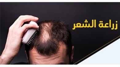 زراعة الشّعر