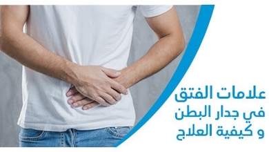 علامات الفتق في جدار البطن وكيفيّة العلاج 
