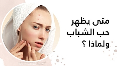 متى يظهر حبّ الشّباب ولماذا ؟ 