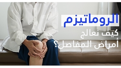 الروماتيزم: اعراض الروماتيزم