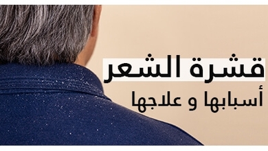 قشرة الشعر: أسبابها و علاجها