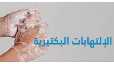 الإلتهابات البكتيرية