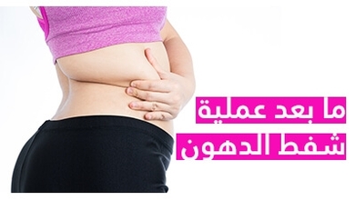 ما بعد عملية شفط الدهون