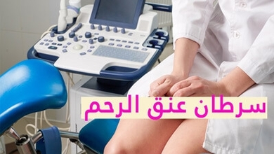 سرطان عنق الرحم: الأعراض والتشخيص والعلاج