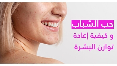 حب الشباب و كيفية إعادة 