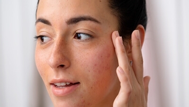 الأمراض الجلديّة الّتي يتسبّب فيها ارتداء الكمامة 