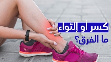 كسر أو التواء ما الفرق