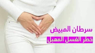 سرطان المبيض خطر الغسل المهبل