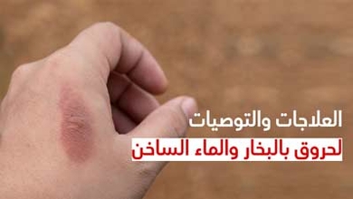 العلاجات والتوصيات لحروق بالبخار والماء الساخن