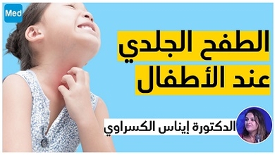 الطفح الجلدي عند الأطفال