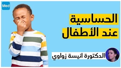 الحساسية عند الأطفال