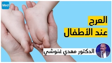 العرج عند الأطفال