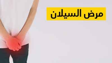 مرض السيلان