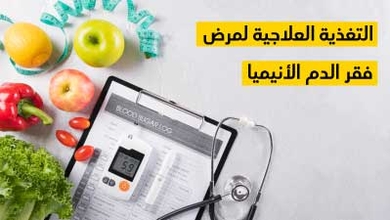 التغذية العلاجية لمرض فقر الدم الأنيميا