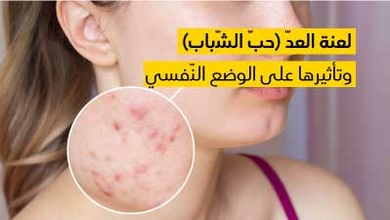 لعنة العدّ (حبّ الشّباب) وتأثيرها على الوضع النّفسي 