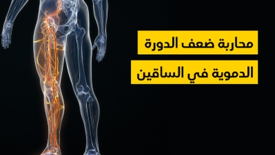 محاربة ضعف الدورة الدموية في الساقين