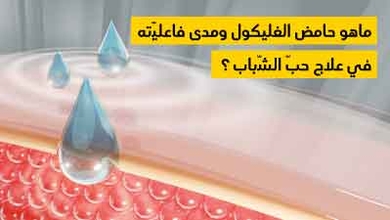 ماهو حامض الغليكول ومدى فاعليّته في علاج حبّ الشّباب ؟