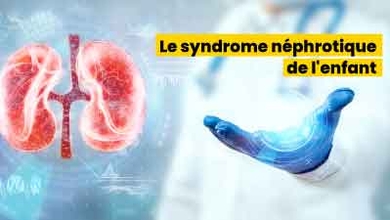 le syndrome néphrotique de l
