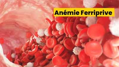 Anémie Ferriprive
