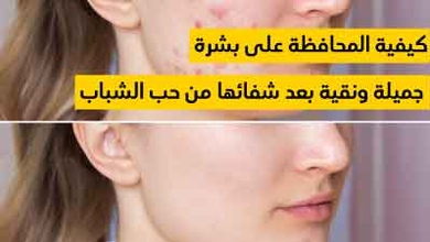 كيفية المحافظة على بشرة جميلة ونقية بعد شفائها من حب الشباب