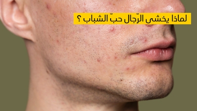 لماذا يخشى الرّجال حبّ الشباب ؟