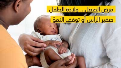 مرض الصعل... ولادة الطّفل صغير الرأس أو توقف النموّ