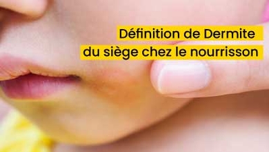 Définition de Dermite du siège chez le nourrisson