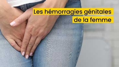 Les hémorragies génitales de la femme 