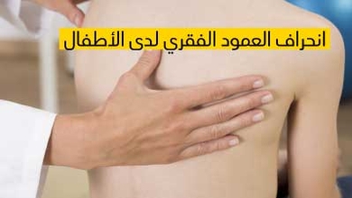 إنحراف العمود الفقري لدى الأطفال 