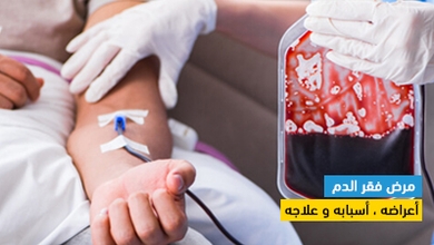 مرض فقر الدم أعراضه ، أسبابه و علاجه