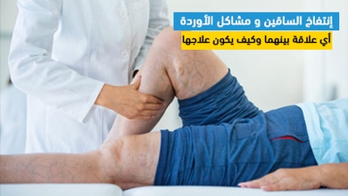 إنتفاخ الساقين و مشاكل الأوردة: أي علاقة بينهما وكيف يكون علاجها