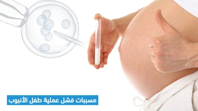 مسببات فشل عملية طفل الأنبوب